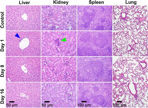 Histopathological Sections Of Liver Kidney Spleen And Lung With HE