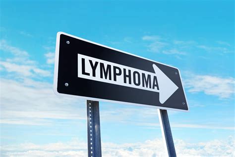 Diffuse Large B Cell Lymphoma Guidelines Rare Disease Advisor