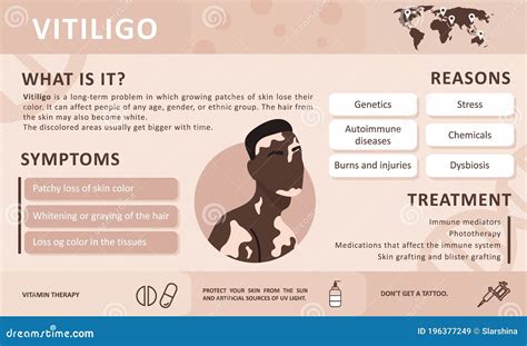 Infographics of Vitiligo. Causes of the Disease. Abstract African Man ...