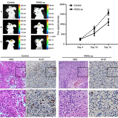 PER2 Inhibited Stemness In GSCs A Tumor Area Measured By In Vivo