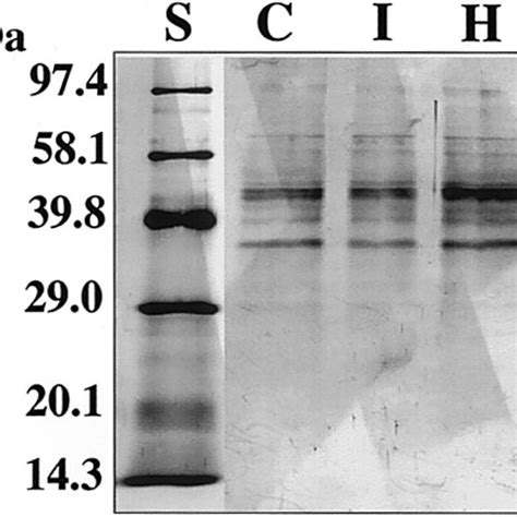 Western blot utilizing the new antibody raised in rabbit against... | Download Scientific Diagram