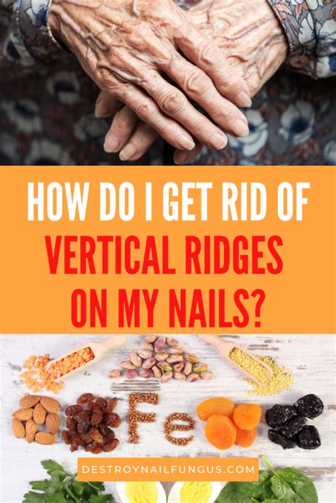 What Do Vertical Ridges On Nails Mean? Causes And Prevention