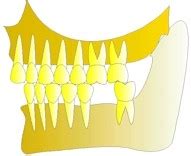 Pourquoi Faut Il Remplacer Les Dents Manquantes Dentalespace