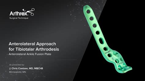 Arthrex Anterolateral Approach For Tibiotalar Arthrodesis