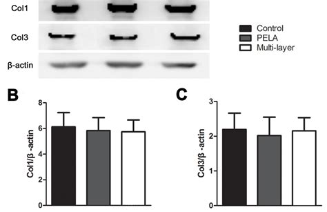 Western Blotting Assay For Collagen I And Collagen Iii Expression In Download Scientific