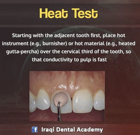 Endodontic Diagnosis Pulp Vitality Tests