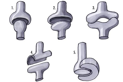 Condyloid Joint Diagram - Wiring Diagram Pictures