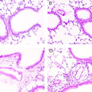 Lung Histopathology H E Staining A Wtc Group B Koc Group