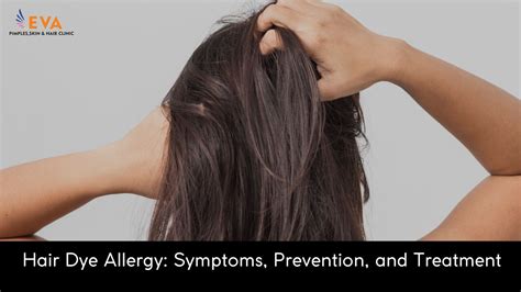 Hair Dye Allergy Symptoms Prevention And Treatment