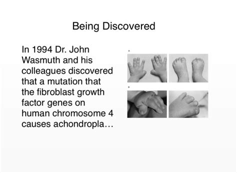 Achondroplasia Screen 3 On Flowvella Presentation Software For Mac