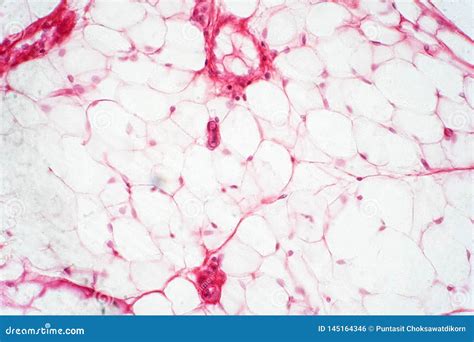 Human Fat Body Tissue Under Microscope View Stock Photo - Image of ...