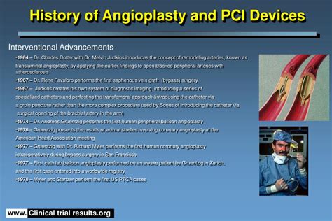 PPT - History of Angioplasty and PCI Devices PowerPoint Presentation ...