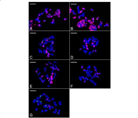 Fluorescent In Situ Hybridization FISH Of Root Tip Metaphase