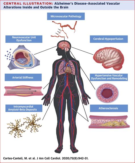 Alzheimers Disease And Vascular Agingjournal Of The American College