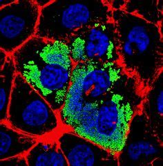 14 Francisella tularensis ideas | bacteria, q fever, things under a microscope