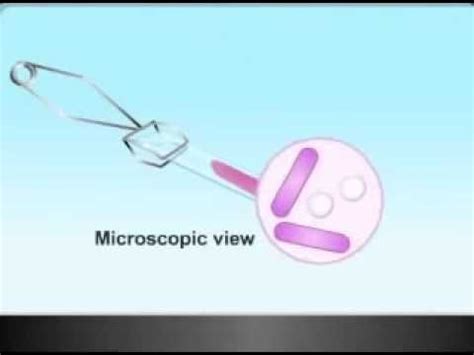 Detailed Principle Reagent Preparation Procedure Result