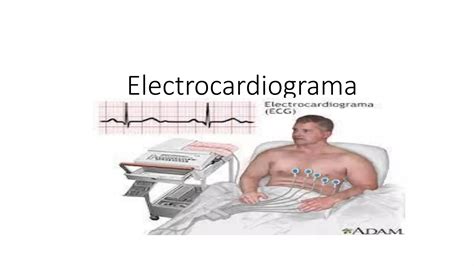 Ecg Electrocardiograma PPT