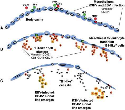 A Model For Primary Effusion Lymphoma Origin A Mesothelial Cells