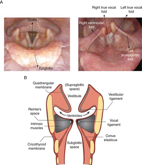 Laryngeal Dysfunction Manifesting As Chronic Refractory Cough And