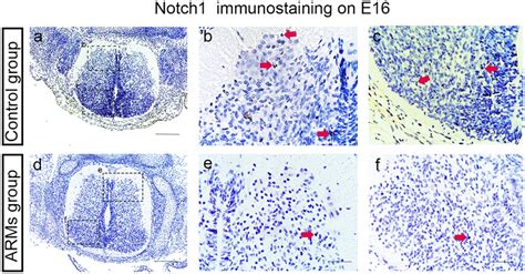 Immunohistochemical Analysis Of Notch1 In The Developing Lumbosacral