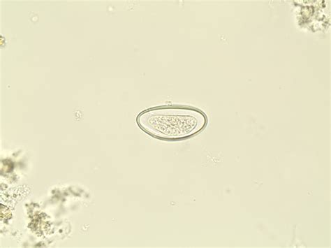 Enterobius Vermicularis Eggs Slide Prepared Slides