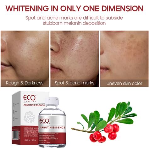 Treating Pigmentations Melasma Dark Spot Corrector Prevent Skin