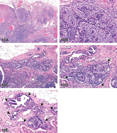 A E Rete Ovarii Adenoma A And B From A Control Sprague Dawley Rat