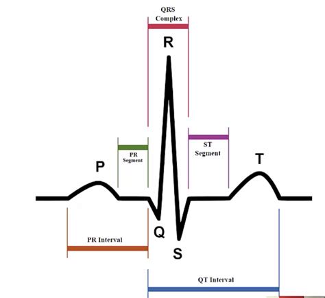 Module 3 Part 2 ECG Rhythm Interpretation Diagram Quizlet