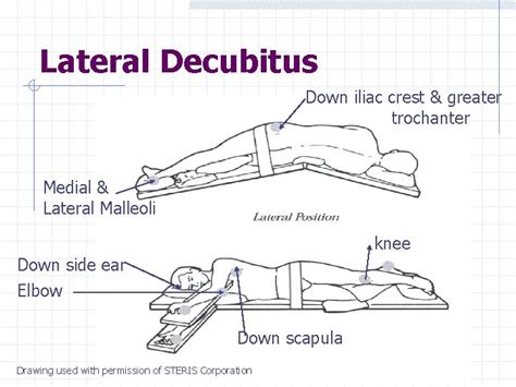 surgical patient positioning prepared  cecile cherry rn