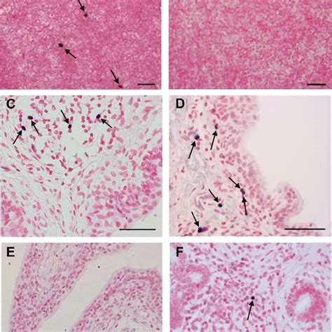 Detection And Localization Of Siv Infected Cells In The Mgt Tissues By