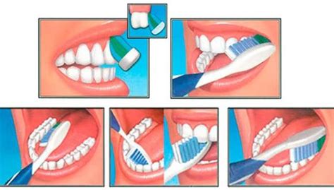 Salud Bucal ¿cuál Es La Manera Correcta De Cepillarse Los Dientes Bienestar El Comercio PerÚ