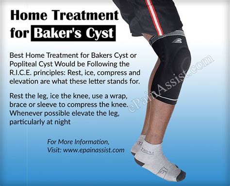 Baker's Cyst Treatment