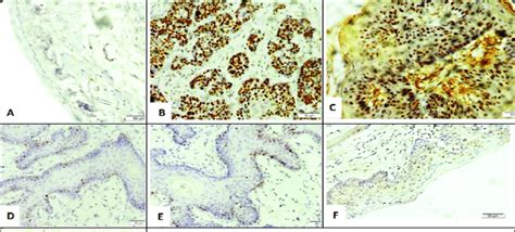 Showing Photomicrographs Of P Immunohistochemical Expressions A