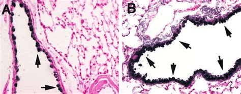 Clara Cell Histology