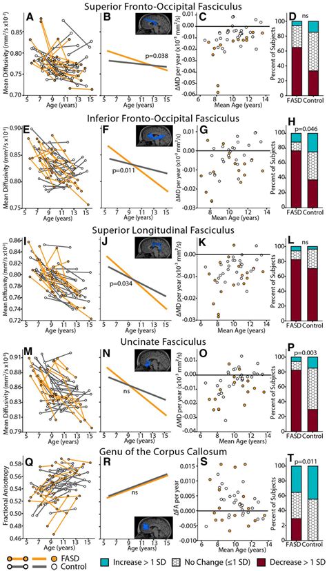 Trajectory Differences Of Diffusion Parameters Md Or Fa With Age