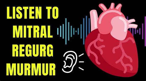 Listen To A Mitral Regurgitation Heart Murmur And Learn About Causes