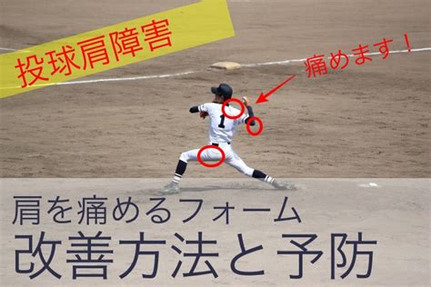 野球でボールを投げると肩の外側が痛い 英気整体院ブログ