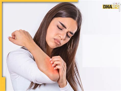 Skin Itching Remedies सर्दियों में हाथ पैरों की खुजली और स्किन रेडनेस से हैं परेशान इन 4 घरेलू