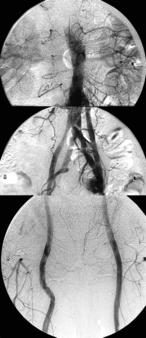 Turkish Journal Of Thoracic And Cardiovascular Surgery