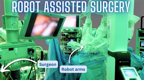 How Robot Assisted Surgery Works As Explained By A Surgeon Youtube