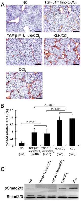 Attenuation Of Ccl4 Induced Hepatic Fibrosis In Mice By Vaccinating