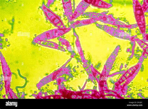 MICROSPORUM CANIS Stock Photo, Royalty Free Image: 49165044 - Alamy