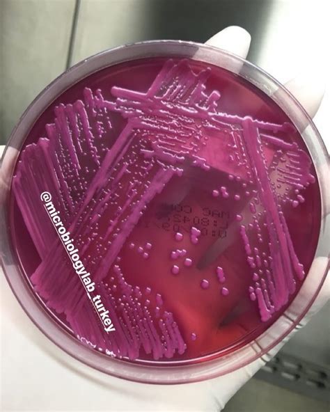 Klebsiella On MacConkey Agar Mikrobiyoloji Microbiology