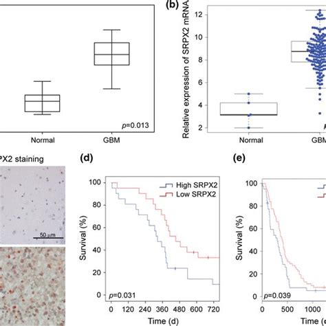 Srpx2 Is Up Regulated In Gbm A Rt Pcr Analysis Of Srpx2 Expression In Download Scientific