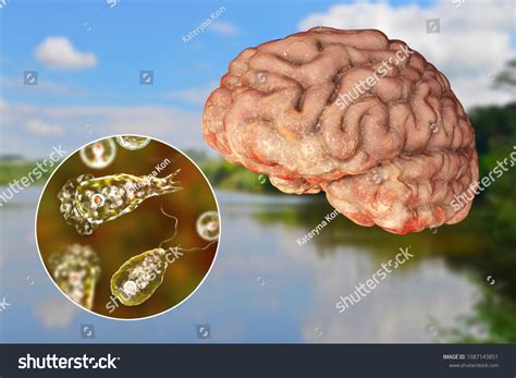 Brain Eating Amoeba Naegleria Fowleri Infections Are Rare