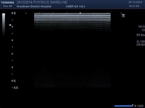 An In Air Reverberation Ultrasound Images From Different Vendors Download Scientific Diagram