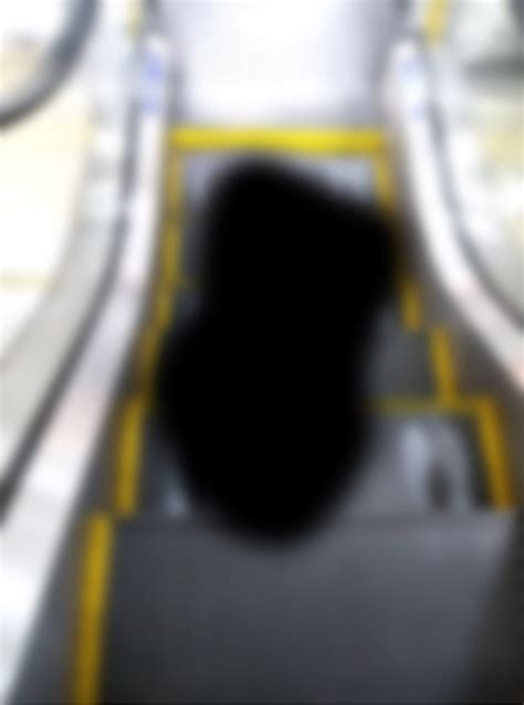 Scotoma (Blind Spot in Eye): Causes, Symptoms & Treatment