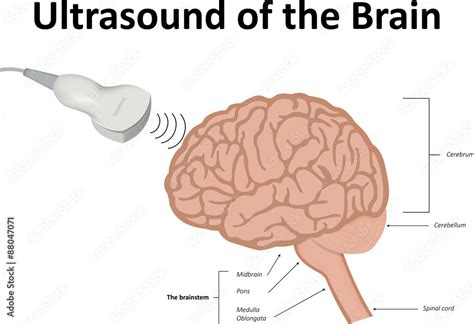 Ultrasound of the Brain Stock Illustration | Adobe Stock