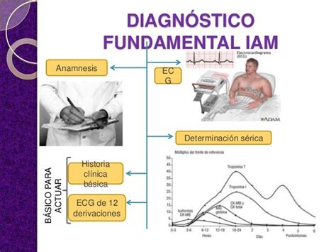 Infarto Agudo De Miocardio