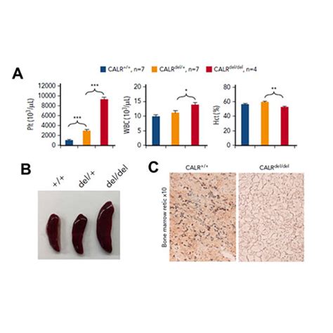 Mouse Models Of Essential Thrombocythemia Et And Myelofibrosis Mf